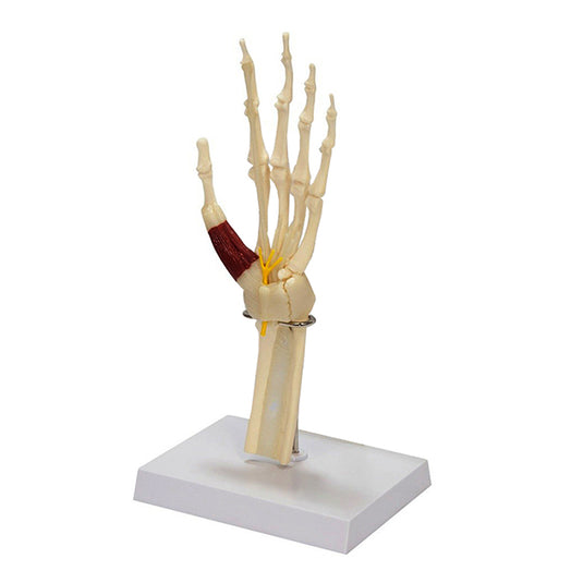 Mô hình Hội chứng Ống cổ tay [SKU: MG35507]