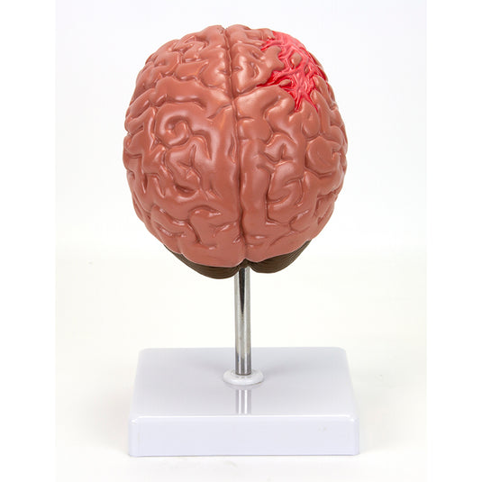 Mô hình Tiết diện Não với Bệnh lý [SKU: MG31100]